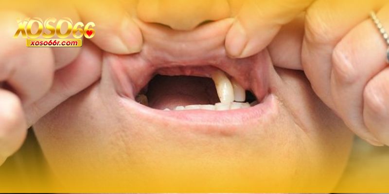 Mơ Thấy Rụng Răng XOSO66 – Giải Mã Giấc Mơ Và Con Số May Mắn 7 Lưu ý con số để dự đoán xổ số.