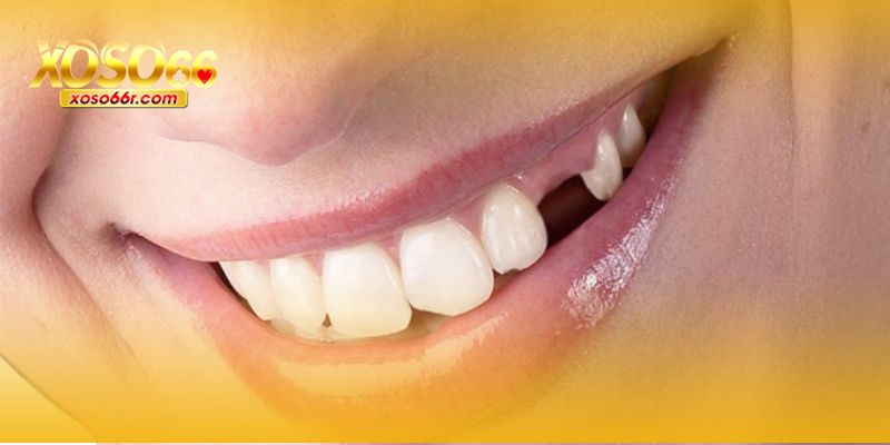 Mơ Thấy Rụng Răng XOSO66 – Giải Mã Giấc Mơ Và Con Số May Mắn 5 Phản ánh lo lắng sức khỏe và tài chính.